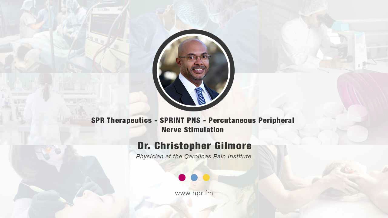 SPR Therapeutics - SPRINT PNS - Percutaneous Peripheral Nerve Stimulation