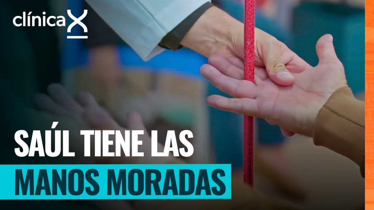 Saúl se siente cansado y tiene fuertes migrañas | Clínica X