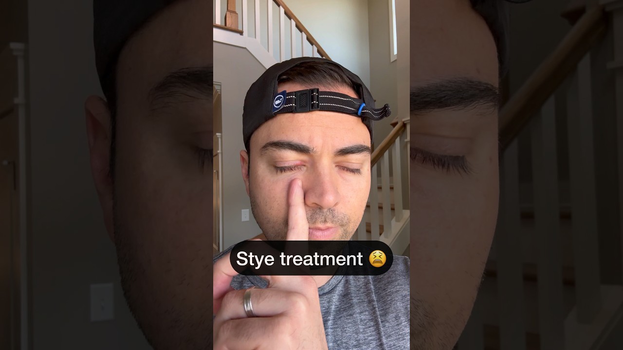 Optometrysta ma jęczmień 👀