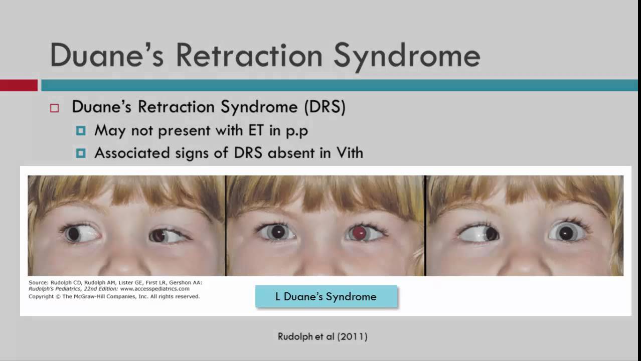 VIth CN Palsy Differential Diagnosis