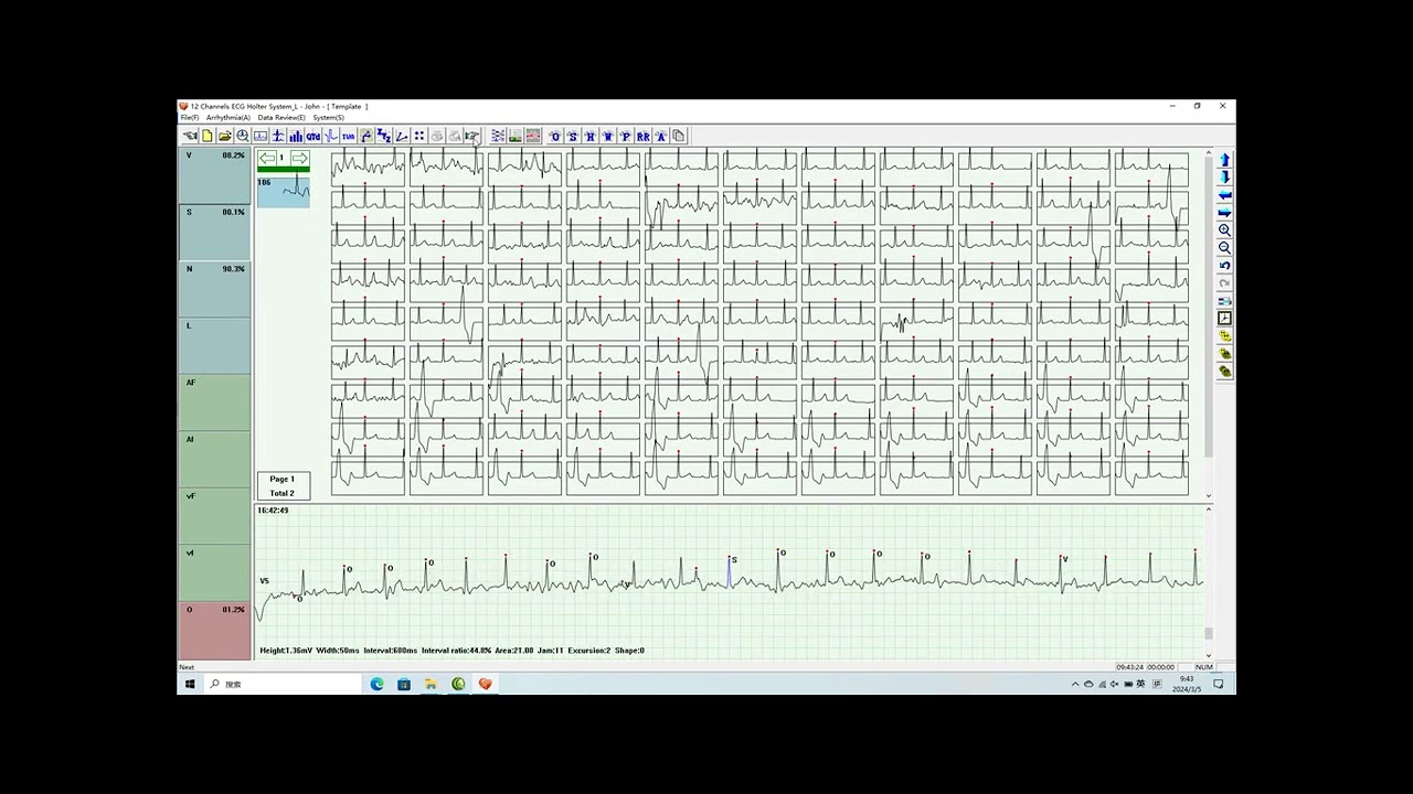 CONTEC TLC6000 operation guide Dynamic ECG Systems