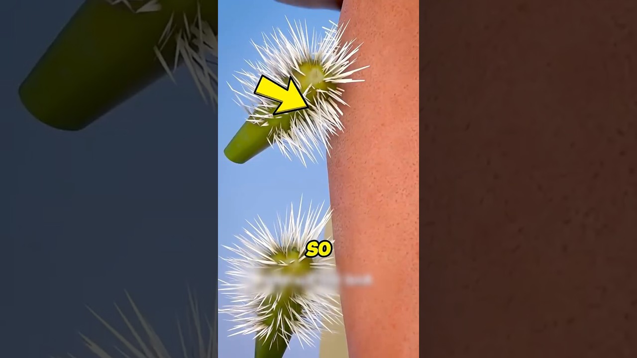 What Happens If You Leave Tiny Splinters In?