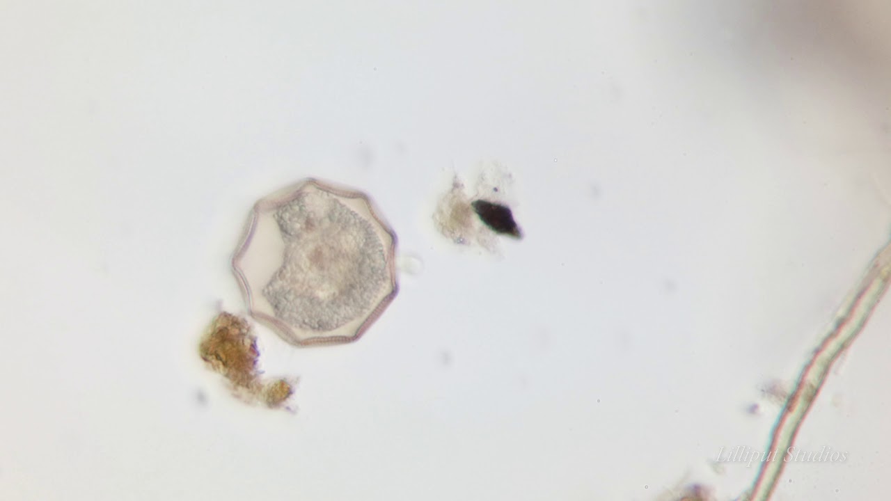 Testate Amoeba - Internal