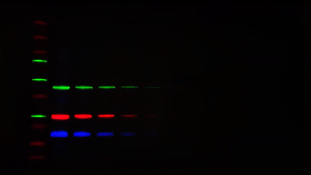 Quick Tips: How to Choose a Primary Antibody for Multiplex Western Blotting