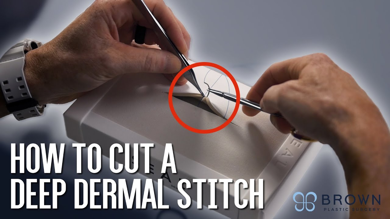 How to cut a Deep Dermal Stitch so NO suture pokes through the skin! | Brown Plastic Surgery