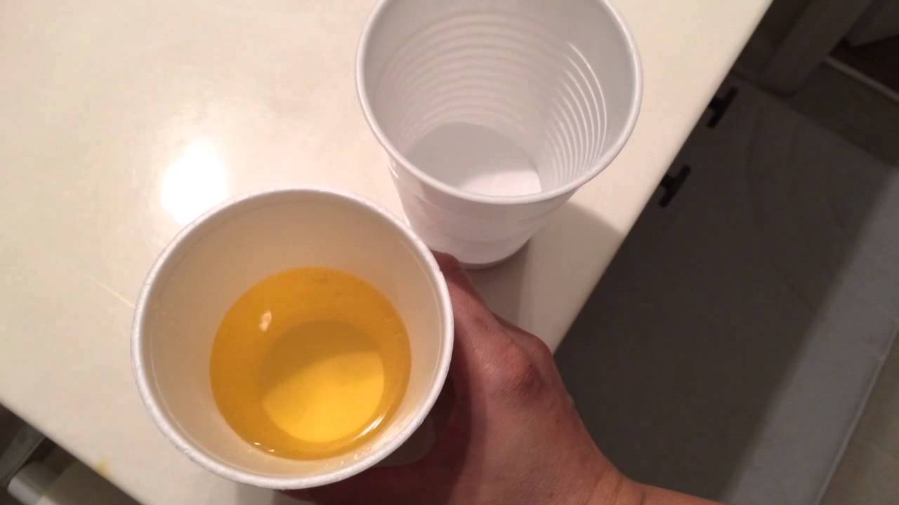 Urine Baby Gender Test