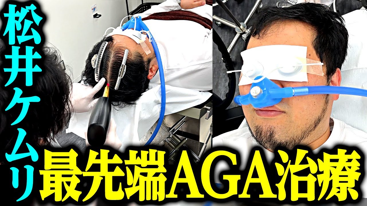 ケムリ、アメリカ産の最先端AGAレーザー治療を受ける。【令和ロマン】