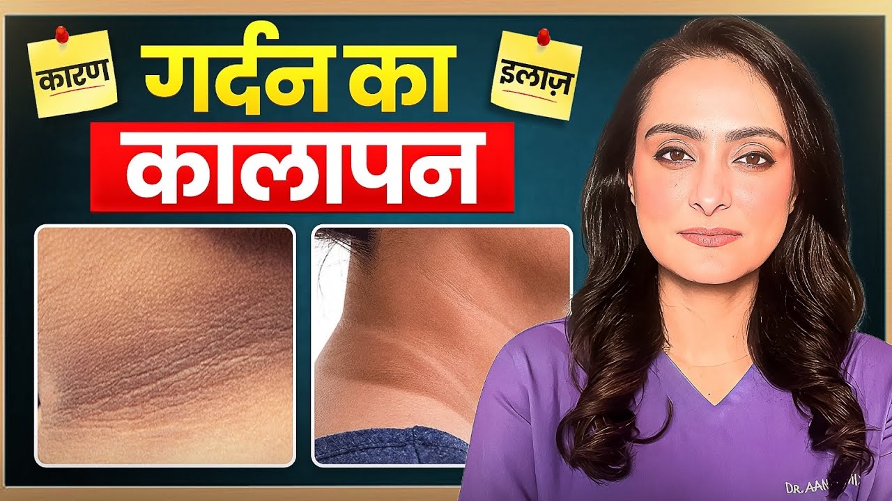 Dark neck , dark underarms | how to treat | Acanthosis Nigricans