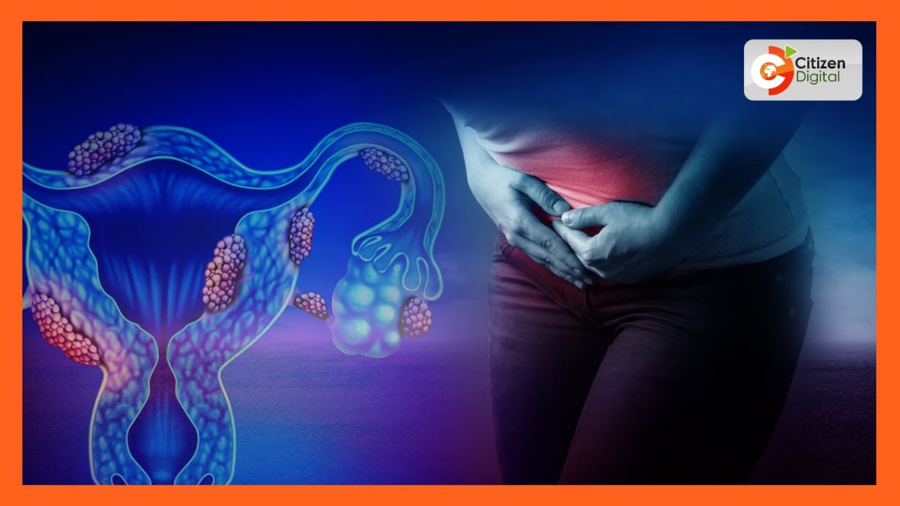Battling with Endometriosis | A chronic inflammatory gynecological disease