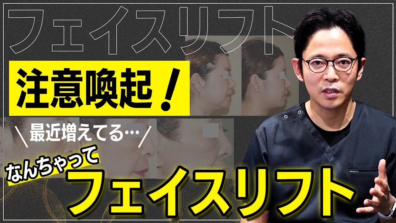 このようなフェイスリフトには注意してください…。