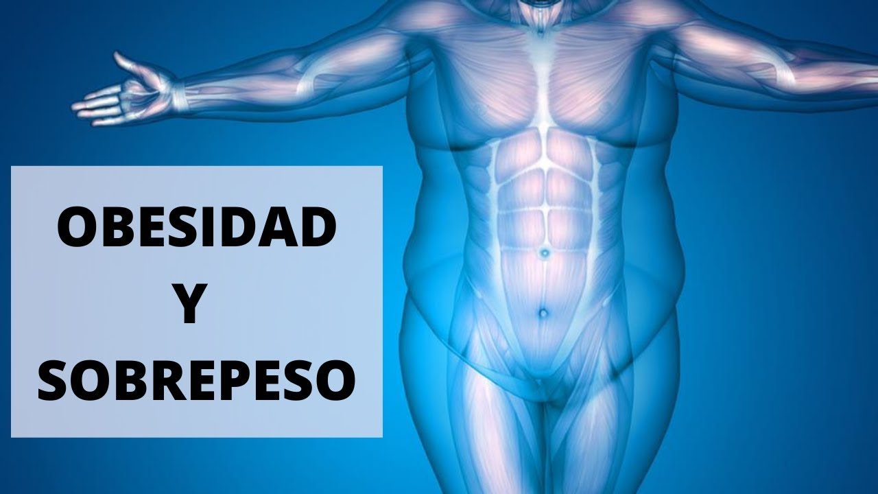 SOBREPESO Y OBESIDAD - lo que debes de saber