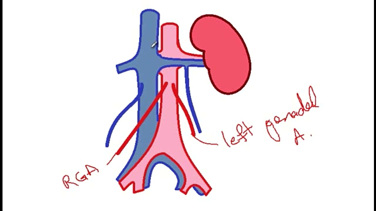 USMLE ACE Video 48: Drainage of Para-aortic Lymph Nodes