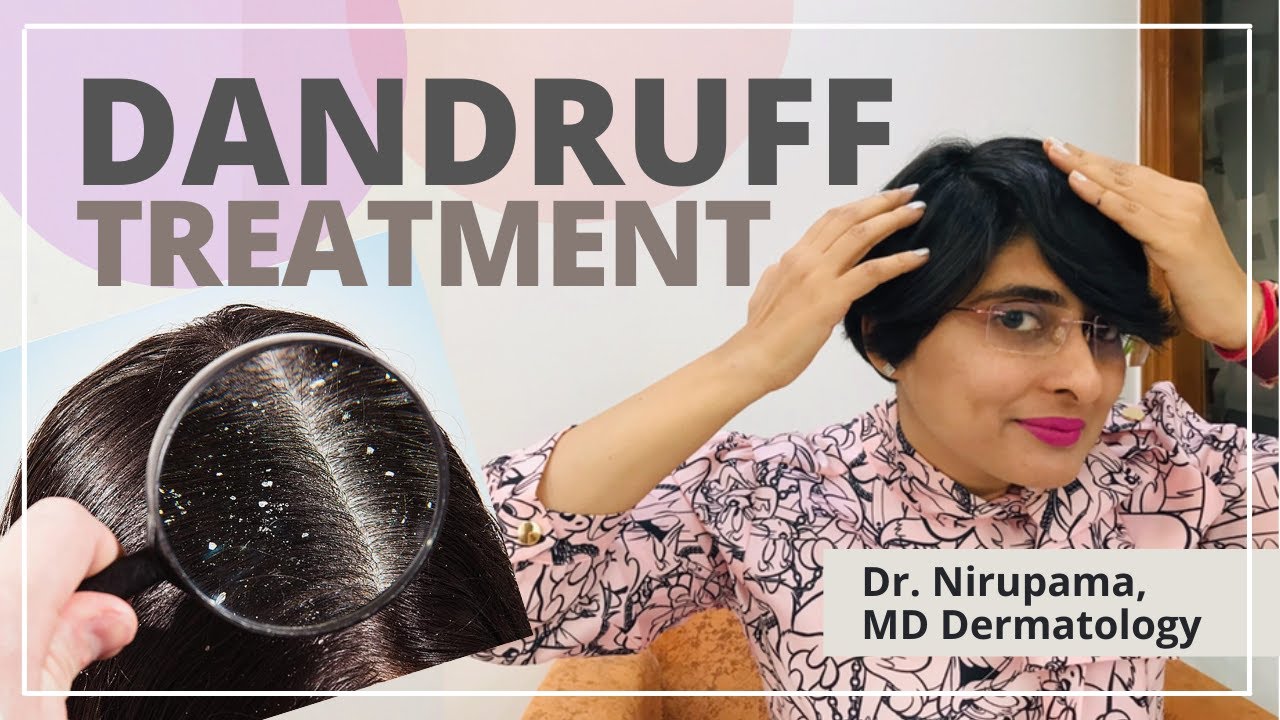 Dandruff shampoo| Dandruff Treatment | Best anti dandruff shampoos in India