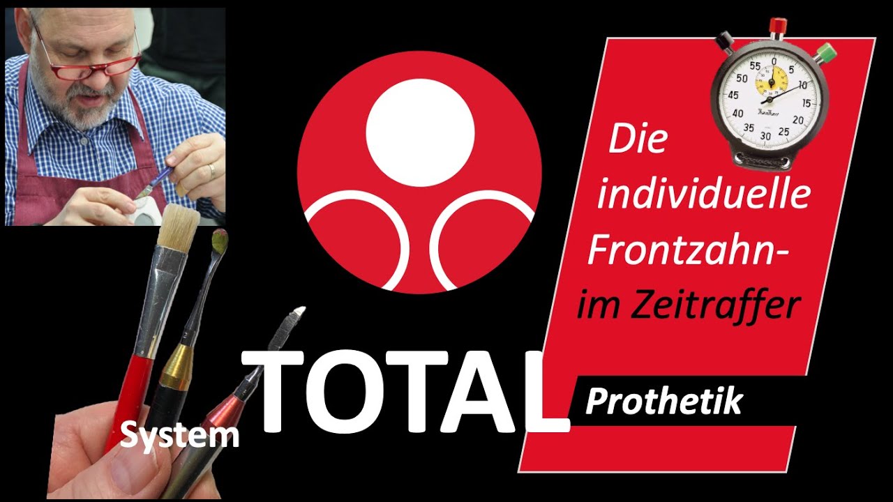 Die Frontzahn-Modellation im Zeitraffer - Teil 3     #KallemachtProthesen