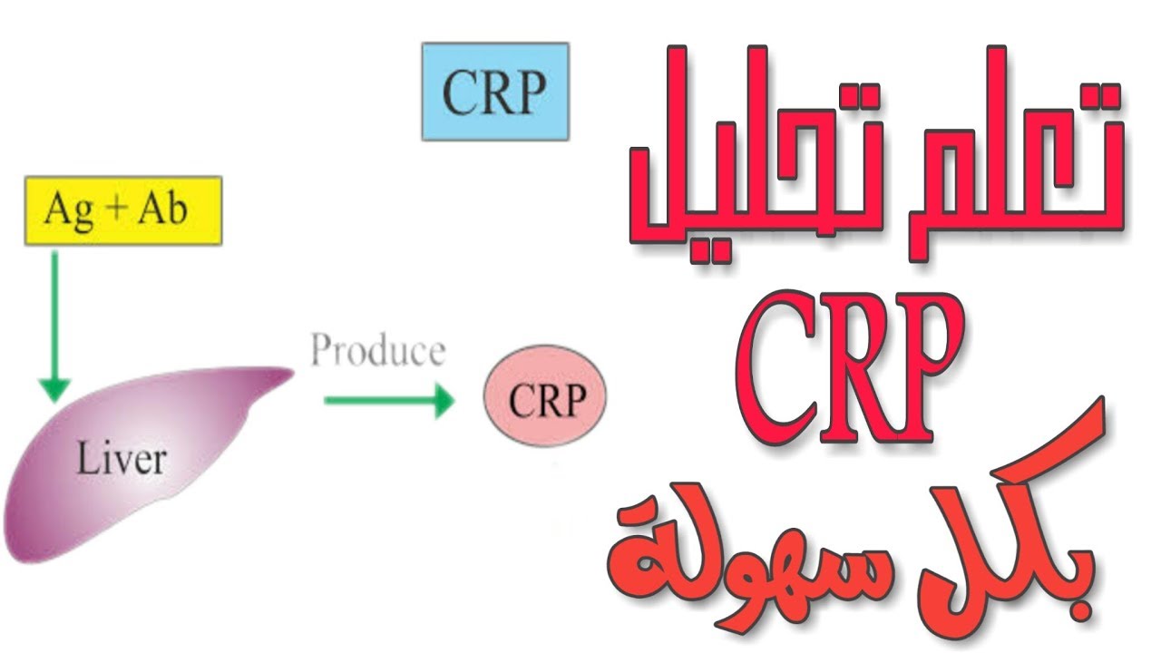 تحليل CRP بكل سهولة الجزء النظري