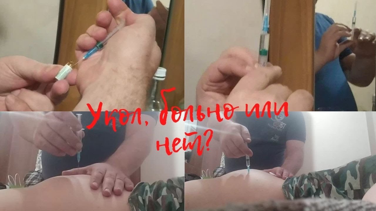 Шок, контент!!! Делаем укол, больно или нет?