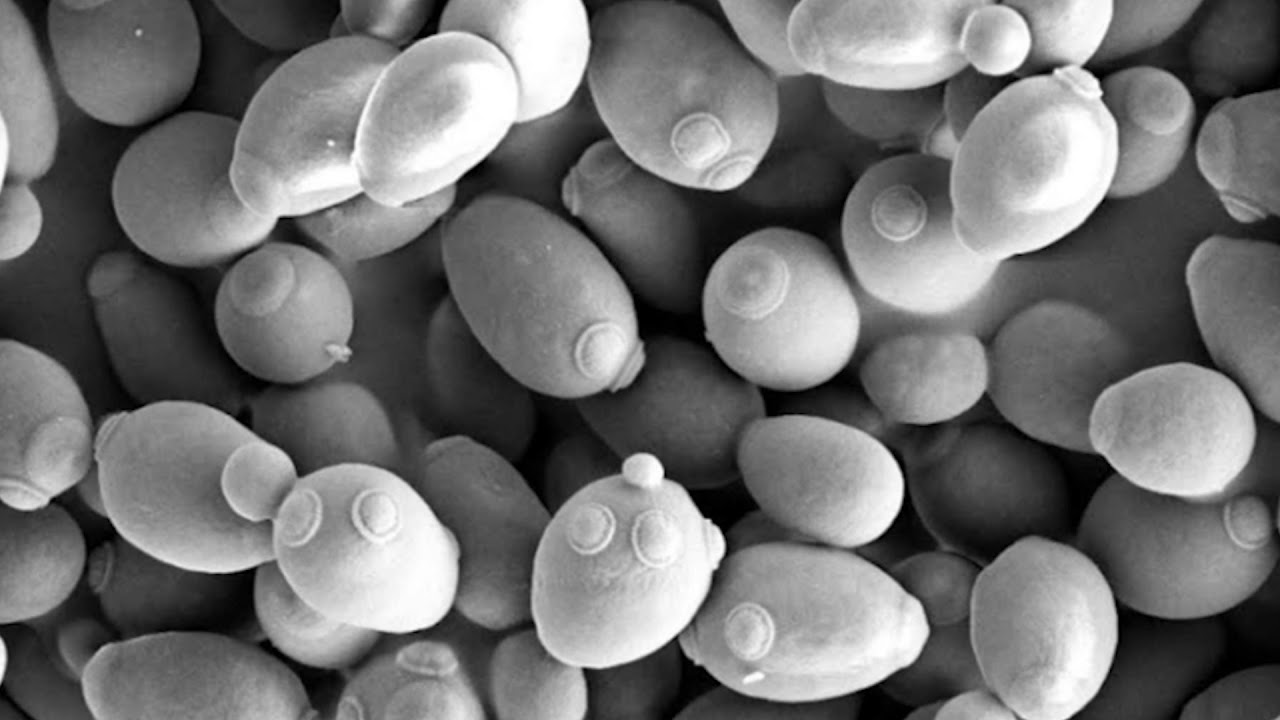 Master Brewers Podcast, Episode 149: Sourvisiae