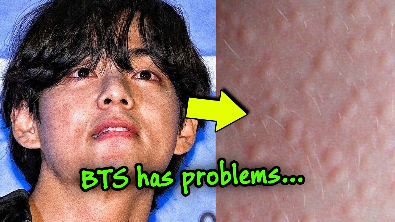 🚨 BTS V Reveals Medical Condition, Manager steps in, News about Suga