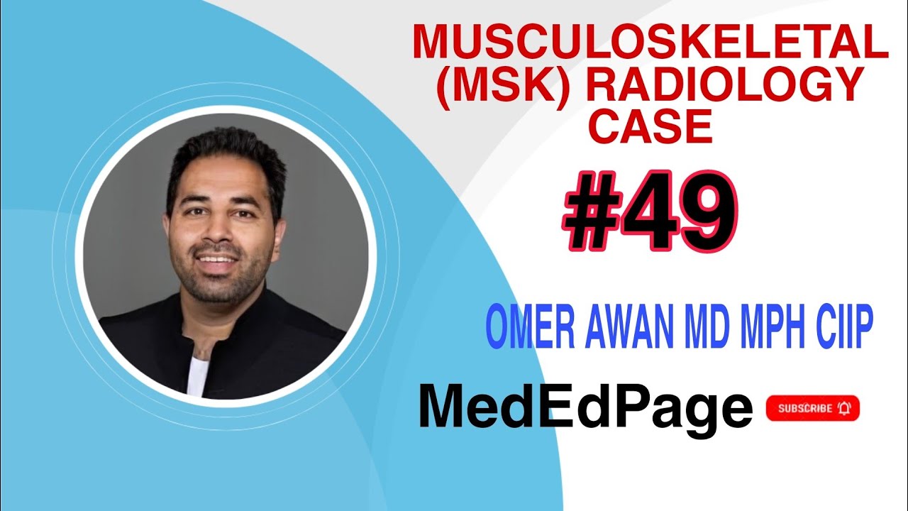 Musculoskeletal (MSK) Radiology CASE #49