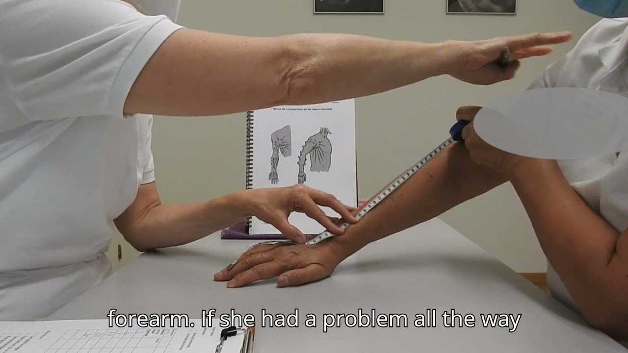 Accurate Edema Measurement: A Step-by-Step Guide for Therapists