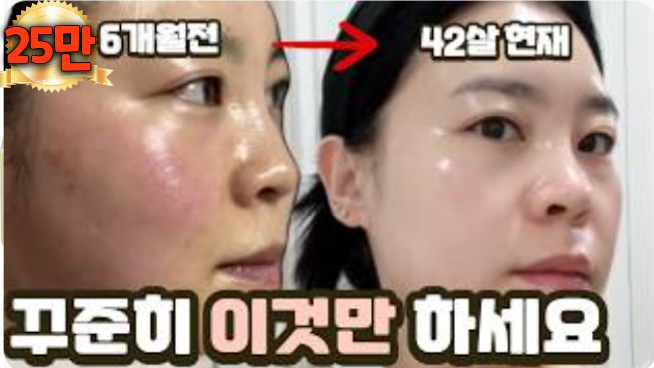 40대 주부의 누구나 피부 좋아지는 데일리루틴🩵 제품, 성분 다 풀음!!
