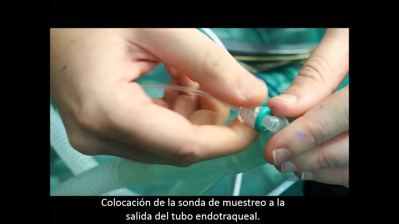 Capnografía