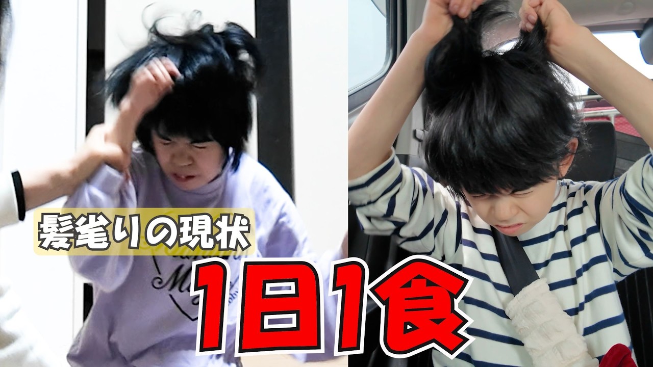【異変】1日1食、ひどい髪毟り。ホルモンと自律神経の影響と向き合う日常