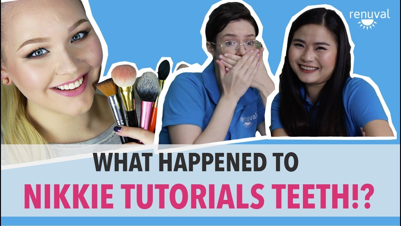 What Changed With Nikkie Tutorials Smile? Dental Investigation!