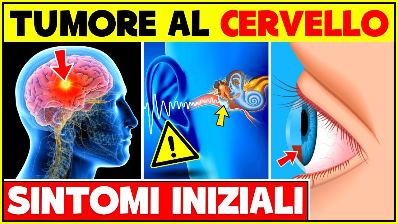 5 Segni e Sintomi Iniziali Di Un Tumore Al Cervello | Non Ignorare Questi Sintomi!