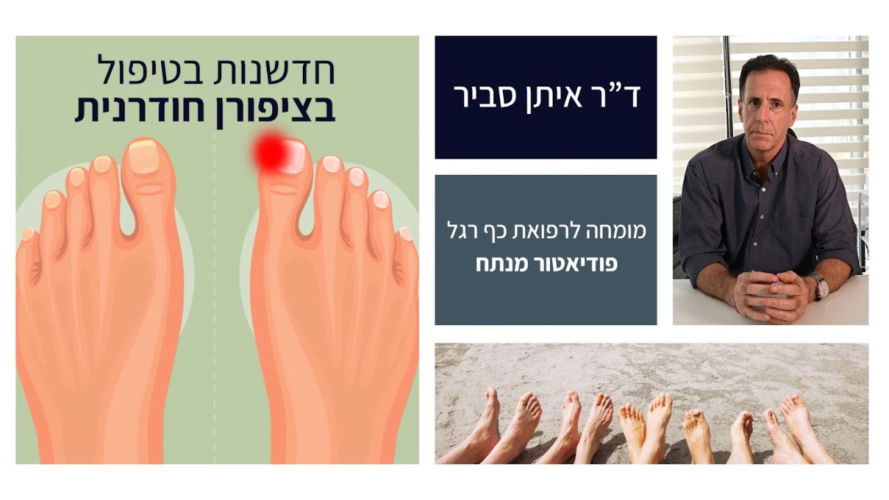 חדשנות בטיפול בציפורן חודרנית – ד