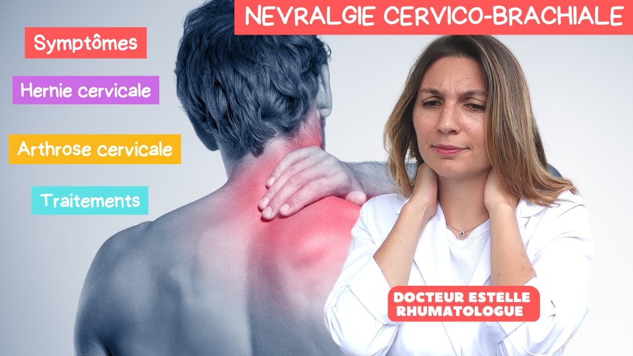 Explication m&eacute;dicale N&eacute;vralgie Cervico-Brachiale