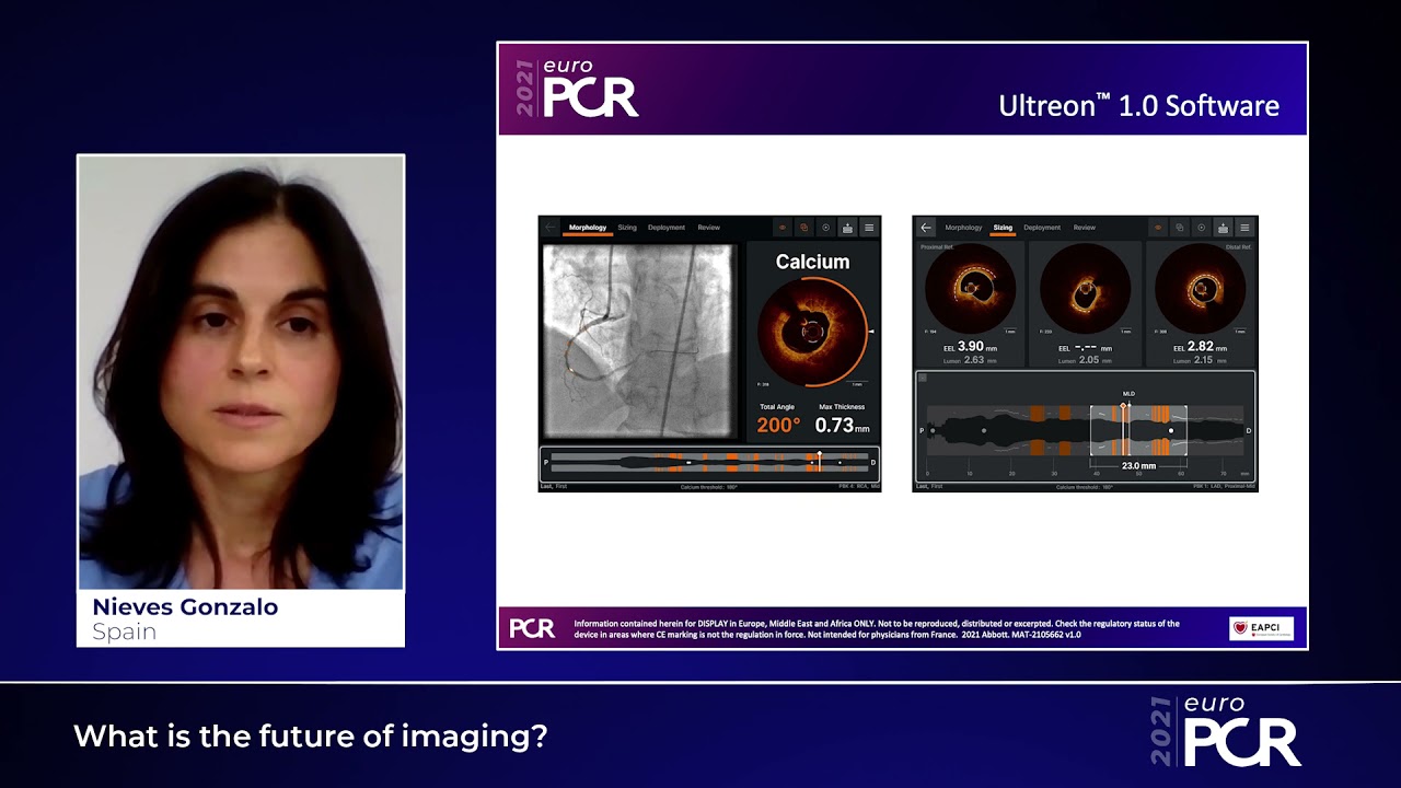 The future and vision of Intravascular Imaging - EuroPCR 2021
