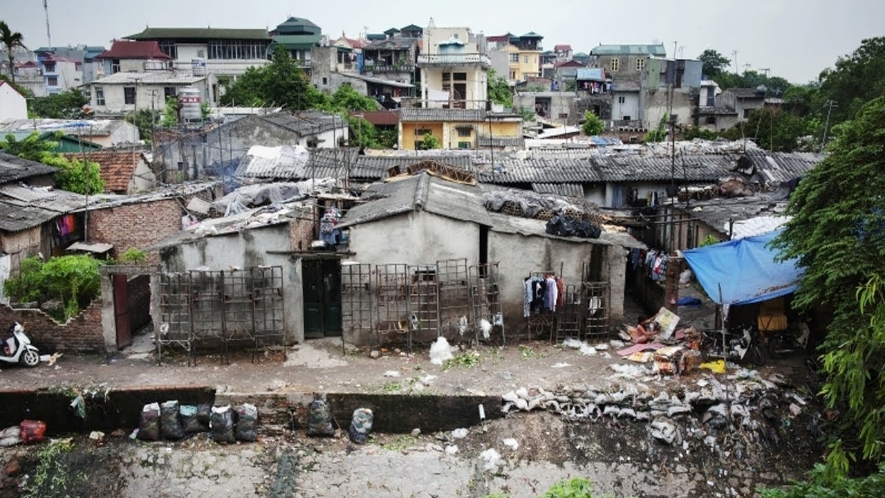Top 10 Most Underdeveloped Countries In The World || Pastimers