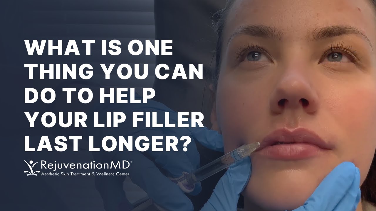 Stunning Lip Filler & How to Help Your Filler Last Longer