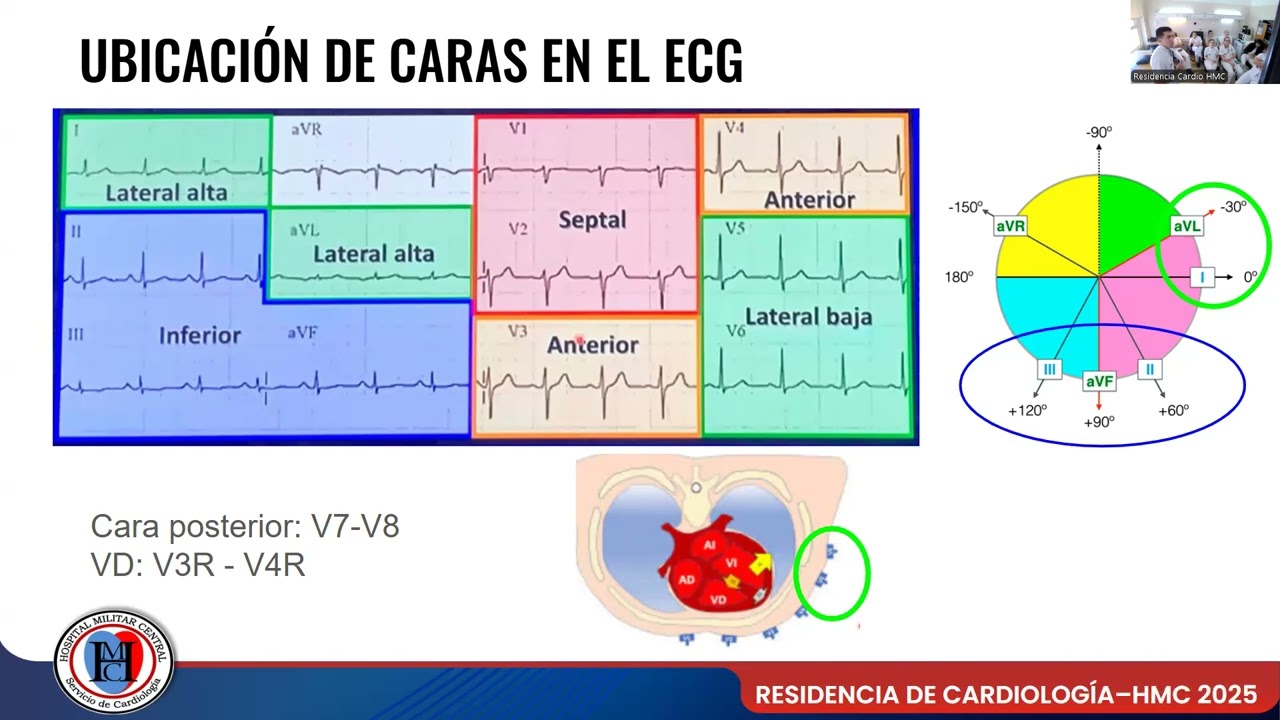 CAMBIOS ISQUEMICOS EN ECG- MODULO SCA