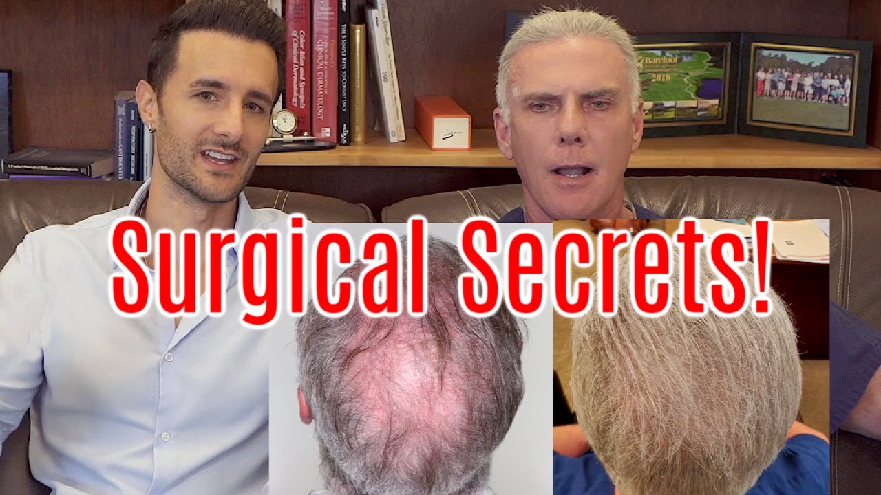 Where Do Hair Transplant Surgeons Go To Get Their Hair Back?