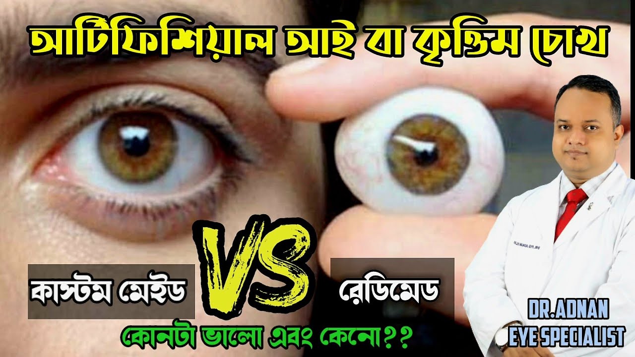 আর্টিফিশিয়াল আই। রেডিমেট কিনবেন না কাস্টম মেইড বানাবেন। কোনটা ভালো এবং কেনো?পাথরের চোখ। Dr.Adnan