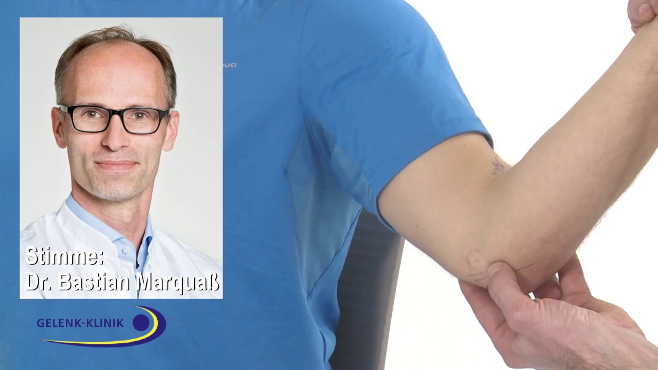 Untersuchungen von Ellenbogenschmerzen &ndash; PD. Dr. Bastian Marqua&szlig;, MVZ Gelenk-Klinik