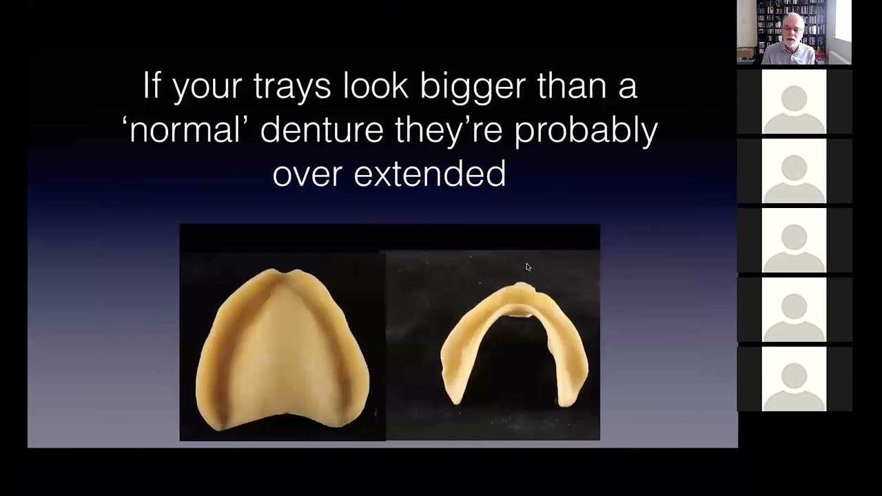 Tutorial on Secondary Impressions for edentulous cases