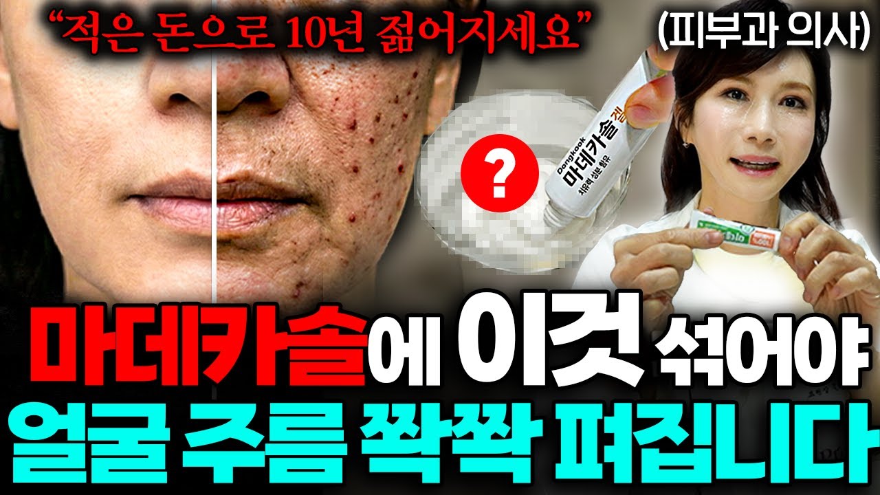 28년차 피부과 원장은 20만원 재생크림 대신 마데카솔에 '이것' 섞어 바릅니다 (한성민 원장 3부)
