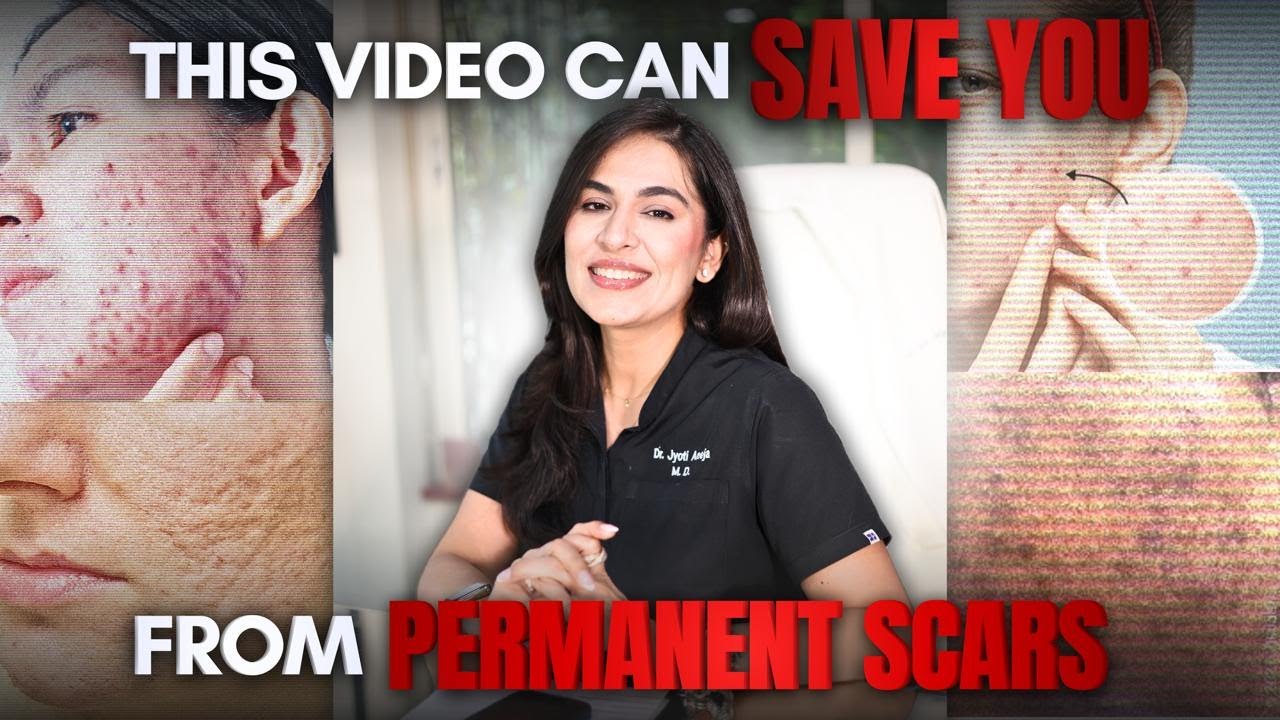 This Video Can Save You From Permanent Scars | Active Acne Treatment | @Dr.JyotiAneja  ​