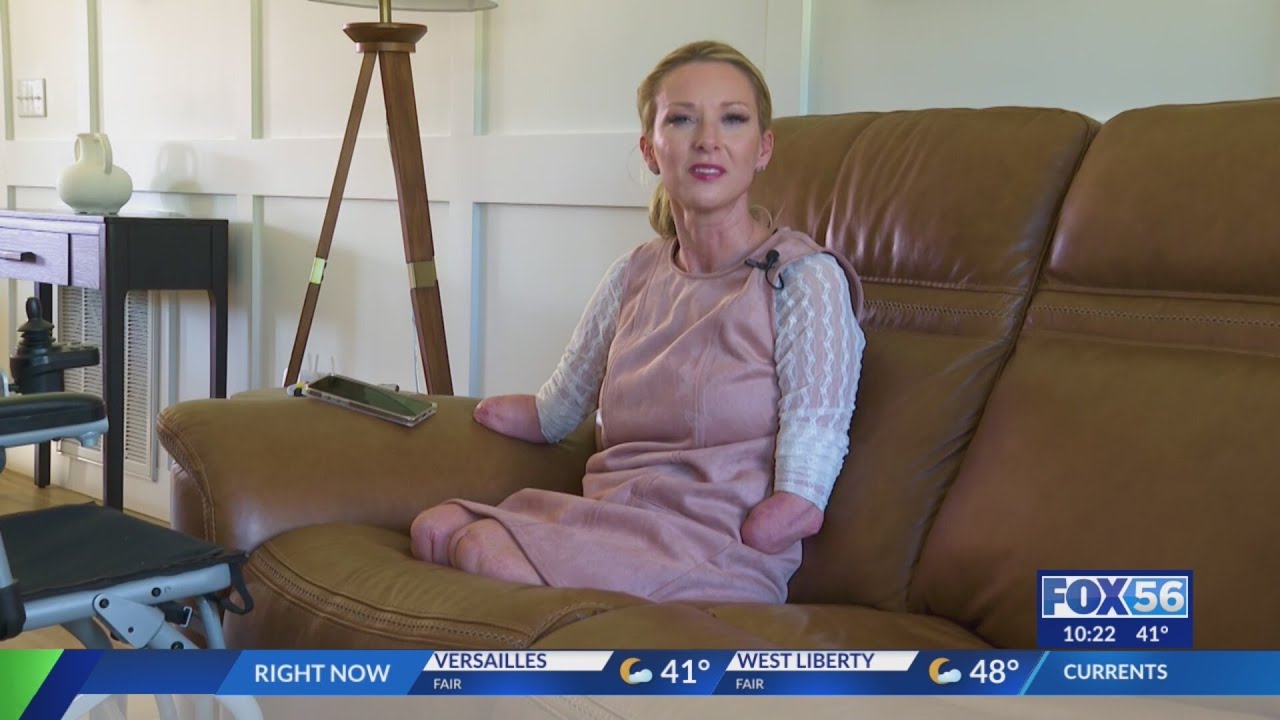 Stanford rallies to help quadruple amputee mom drive again