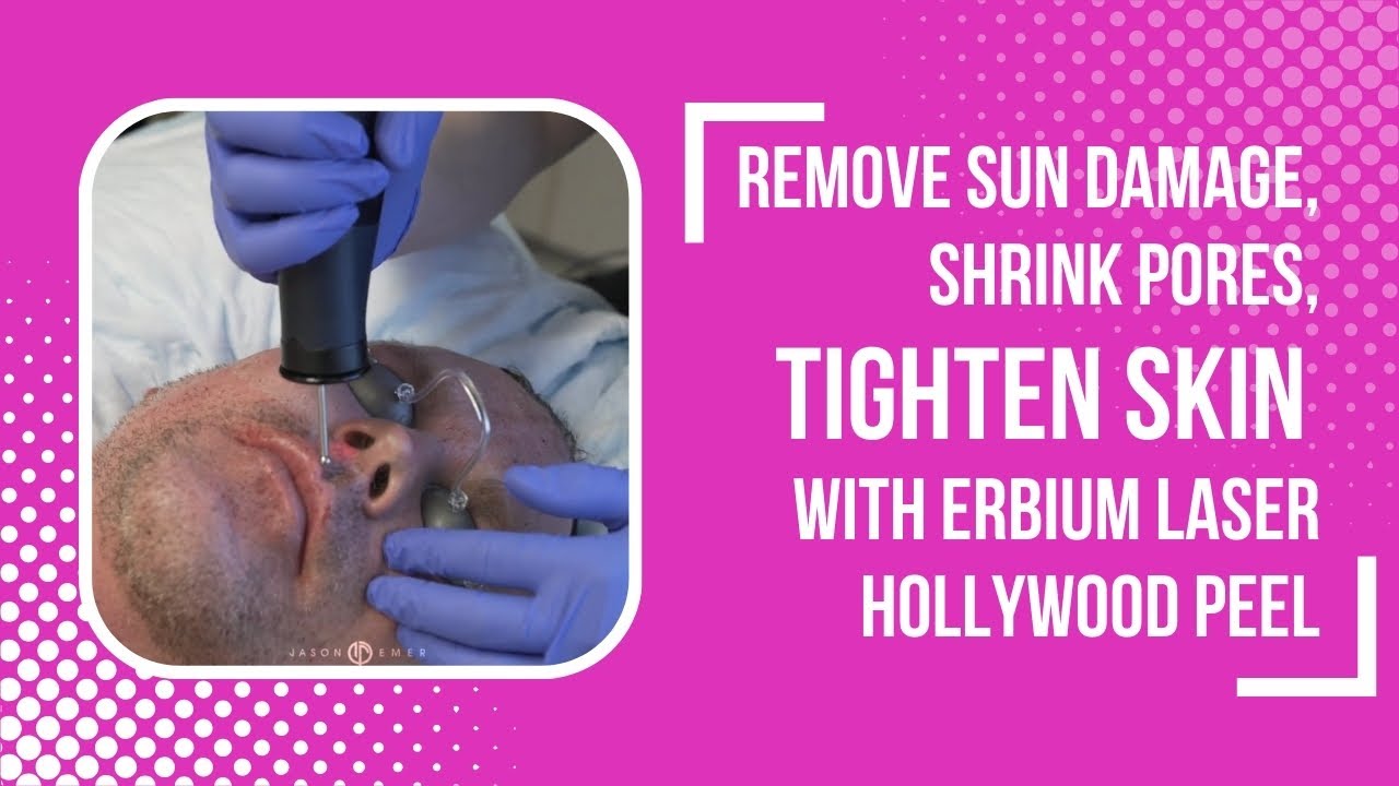 REMOVE SUN DAMAGE, SHRINK PORES, TIGHTEN SKIN WITH ERBIUM LASER HOLLYWOOD PEEL | Dr. Jason Emer