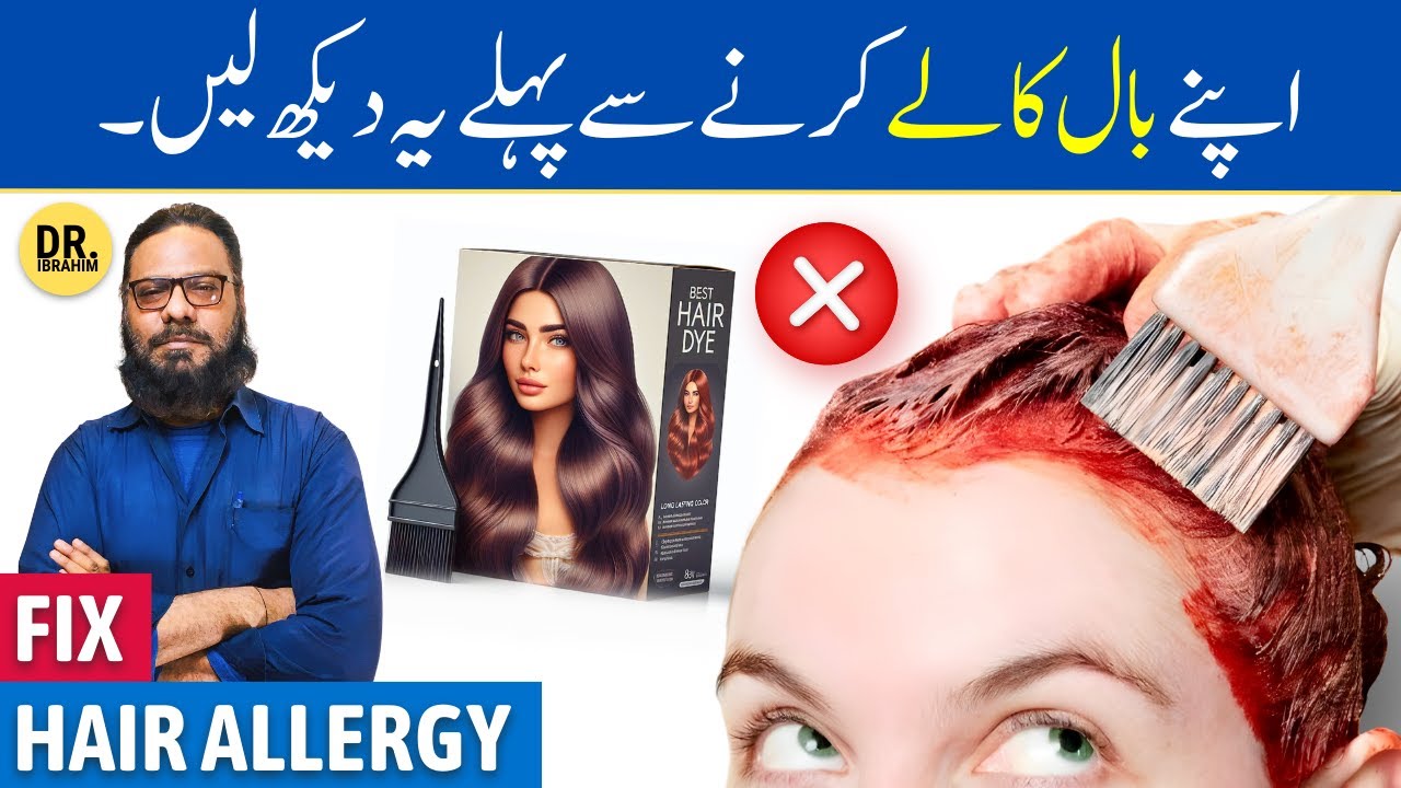 Hair Dye Allergy Ka Ilaj | Kizab Lagana/Baal Kale Karne Ke Nuksan | Dr. Ibrahim