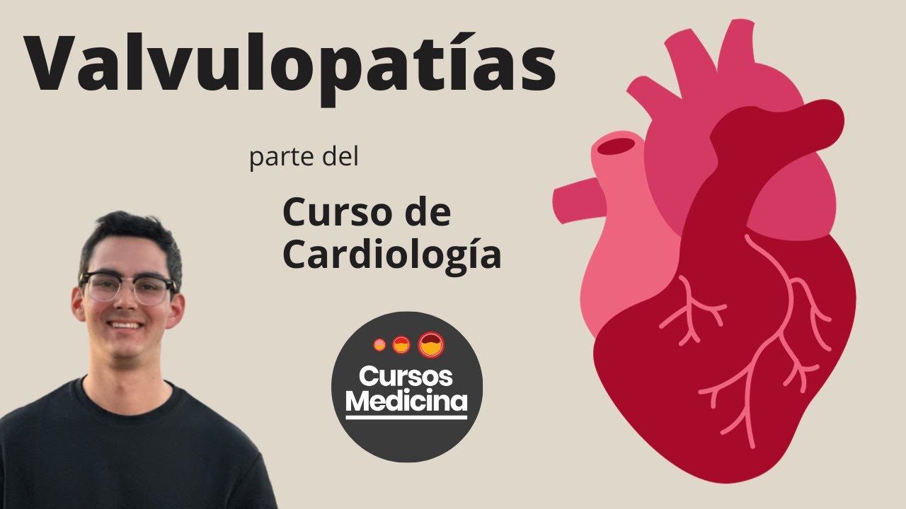 Valvulopatías - Estenosis Aórtica, Insuficiencia Aórtica, Estenosis Mitral, Insuficiencia Mitral