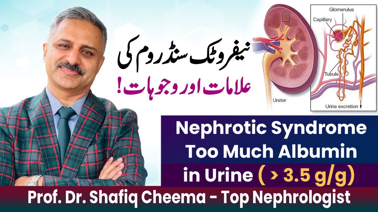 Albuminuria Video 3 : Nephrotic Syndrome or Heavy  Proteinuria | More than 3.5 g/g #proteinuria