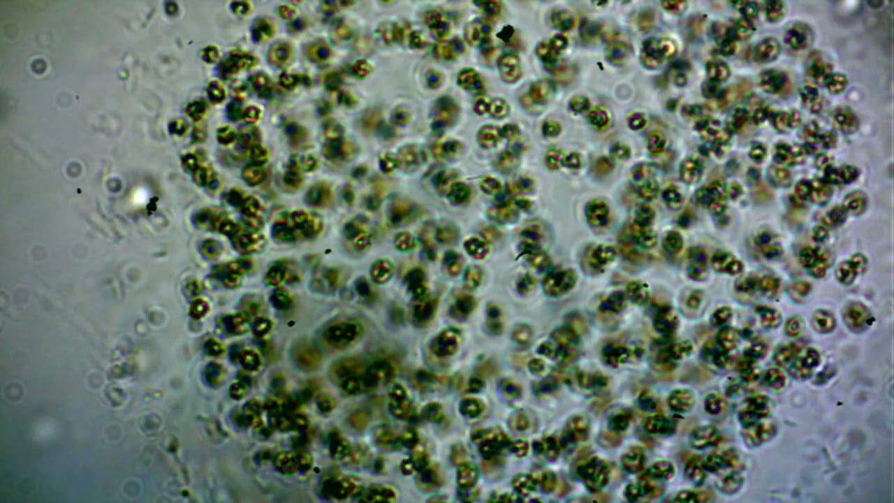 MIcrocystis, la cianobacteria que causa muchos problemas.