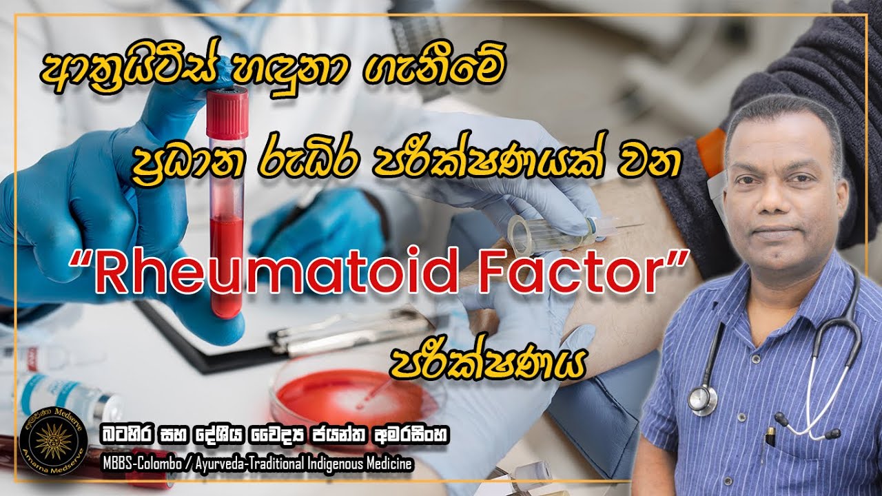 ආත්‍රයිටිස් හදුනා ගැනිමේ ප්‍රධාන රුධිර පරීක්ෂණයක් වන Rheumatoid Factor පරීක්ෂණය #rhfact #rhfactor