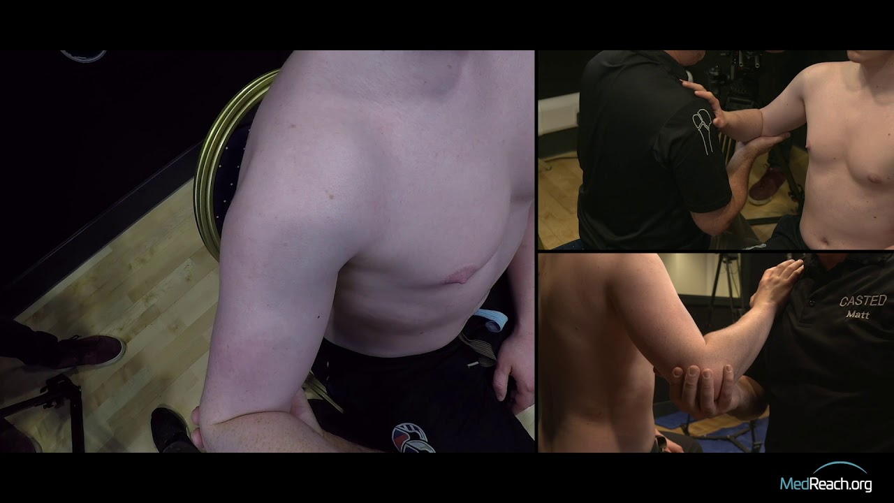 The Cunningham Technique (multi-angle)