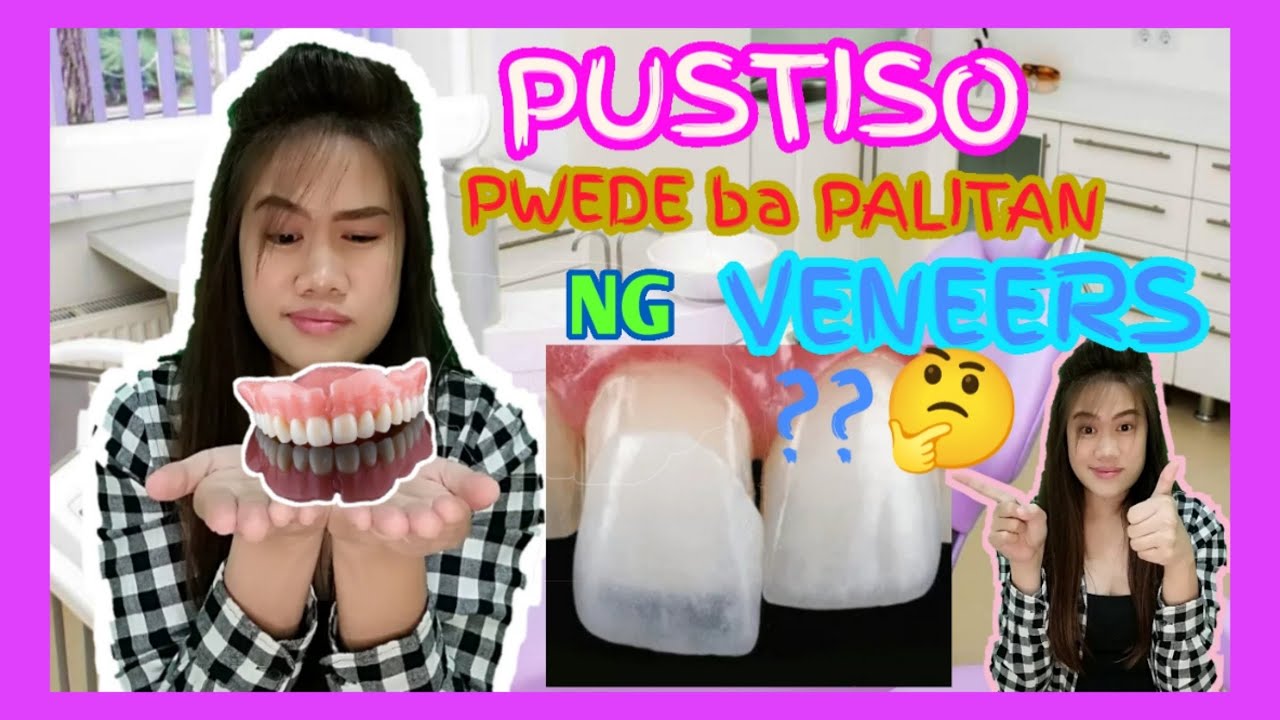 PUSTISO DATI GUSTO PAPALITAN NG VENEERS? PWEDE? 🤔 dental clinic in kuwait